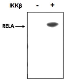 RELA (phospho S536), Rabbit anti-Human, Mouse, Rat, Polyclonal Antibody, Abnova 100 &mu;g | Buy Online | Abnova | Fisher Scientific