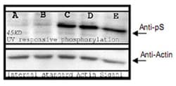 Phosphoserine Rabbit, Polyclonal Antibody, Abnova 100&mu;g; Unlabeled:Antibodies,