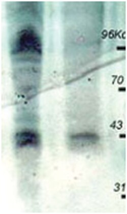 Phosphothreonine, Rabbit, Polyclonal Antibody, Abnova 100&mu;g; Unlabeled:Antibodies,