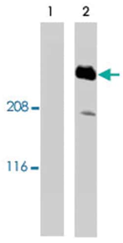 SSeCKS, Sheep, Polyclonal Antibody, Abnova 250 &mu;g | Buy Online | Abnova Corporation | Fisher Scientific