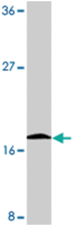 Birc5 Rabbit anti-Mouse, Polyclonal Antibody, Abnova 100&mu;g; Unlabeled:Antibodies,