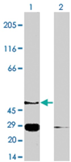 S1PR4 Rabbit anti-Human, Polyclonal Antibody, Abnova 100&mu;g; Unlabeled:Antibodies,
