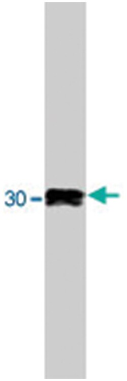SR beta, Sheep, Polyclonal Antibody, Abnova 250 &mu;g | Buy Online | Abnova | Fisher Scientific