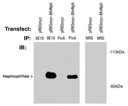 Nephrophthisis (pic), Rabbit, Polyclonal Antibody, Abnova 250&mu;g; Unlabeled:Antibodies,