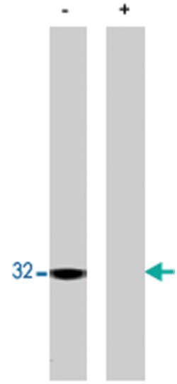 PPP1CA Rabbit anti-Bovine, Human, Mouse, Rat, Polyclonal Antibody, Abnova