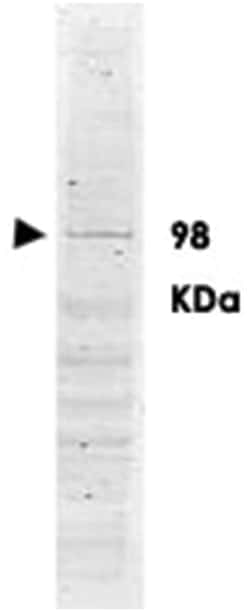 POLK, Goat, Polyclonal Antibody, Abnova 100&mu;g; Unlabeled:Antibodies,