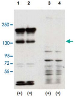 SIPA1 Rabbit anti-Human, Mouse, Rat, Polyclonal Antibody, Abnova 100&mu;g;