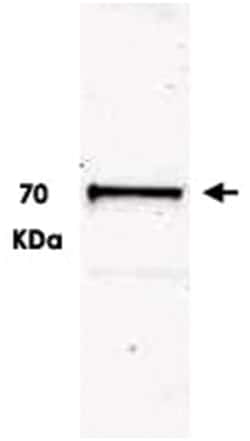 Ubash3b, Rabbit, Polyclonal Antibody, Abnova 100&mu;g; Unlabeled:Antibodies,