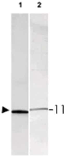 S100A1/S100B, Rabbit, Polyclonal Antibody, Abnova 500&mu;g; Unlabeled:Antibodies,