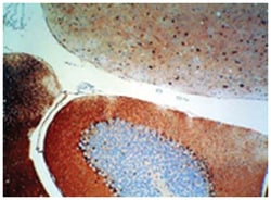 S100A1/S100B, Rabbit, Polyclonal Antibody, Abnova 500&mu;g; Unlabeled:Antibodies,