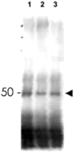 MER2 Rabbit anti-Yeast, Polyclonal Antibody, Abnova 100 &mu;g | Buy Online | Abnova | Fisher Scientific