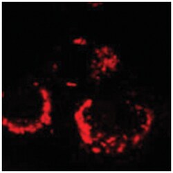 orf1ab (SARS orf1ab) Rabbit anti-Viruses, Polyclonal Antibody, Abnova 100μL;