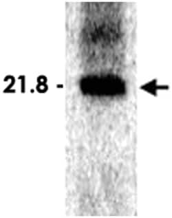 orf1ab (SARS orf1ab) Rabbit anti-Viruses, Polyclonal Antibody, Abnova 100μL;