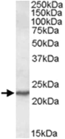 SAR1A, Goat, Polyclonal Antibody, Abnova 100&mu;g; Unlabeled:Antibodies,