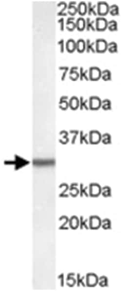 Dpm1, Goat, Polyclonal Antibody, Abnova 100&mu;g; Unlabeled:Antibodies,