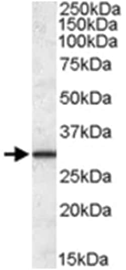ERP29, Goat, Polyclonal Antibody, Abnova 100μg; Unlabeled:Antibodies,