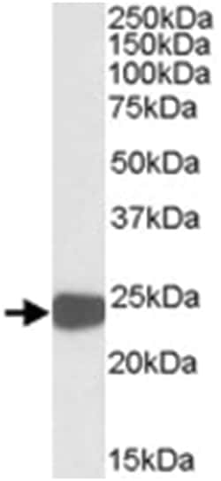 PRDX1, Goat, Polyclonal Antibody, Abnova 100&mu;g; Unlabeled:Antibodies,