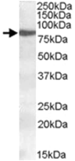 ALOX15, Goat, Polyclonal Antibody, Abnova 100&mu;g; Unlabeled:Anticuerpos