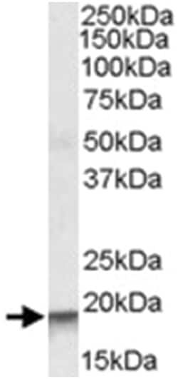 ARPC4, Goat, Polyclonal Antibody, Abnova 100&mu;g; Unlabeled:Antibodies,
