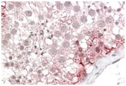 ABCD3, Goat, Polyclonal Antibody, Abnova 100&mu;g; Unlabeled:Antibodies,