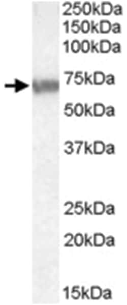 ABCD4, Goat, Polyclonal Antibody, Abnova 100&mu;g; Unlabeled:Antibodies,