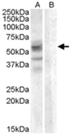 ARSD, Goat, Polyclonal Antibody, Abnova 100&mu;g; Unlabeled:Antibodies,