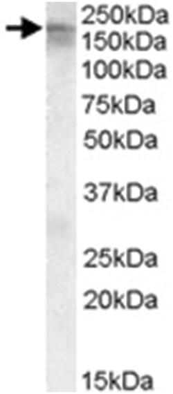 CACNA1C, Goat, Polyclonal Antibody, Abnova 100&mu;g; Unlabeled:Antibodies,