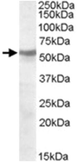 CHRNB1, Goat, Polyclonal Antibody, Abnova 100&mu;g; Unlabeled:Antibodies,