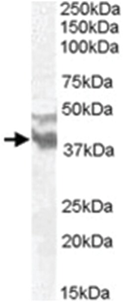 DYX1C1 Goat anti-Human, Polyclonal Antibody, Abnova 100&mu;g; Unlabeled:Antibodies,