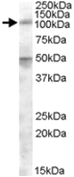 ERAP2, Goat, Polyclonal Antibody, Abnova 100&mu;g; Unlabeled:Antibodies,