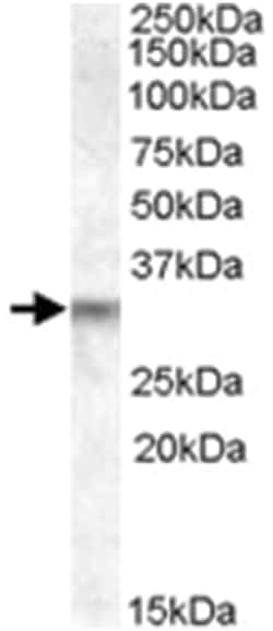 PRUNE2, Goat, Polyclonal Antibody, Abnova 100&mu;g; Unlabeled:Antibodies,