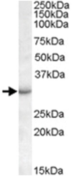 RAB23, Goat, Polyclonal Antibody, Abnova 100&mu;g; Unlabeled:Antibodies,