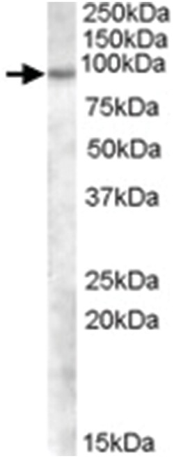 TCHHL1, Goat, Polyclonal Antibody, Abnova 100&mu;g; Unlabeled:Antibodies,