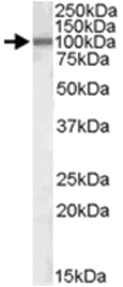 ZEB1, Goat, Polyclonal Antibody, Abnova 100&mu;g; Unlabeled:Antibodies,