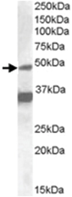 NR1I2, Goat, Polyclonal Antibody, Abnova 100&mu;g; Unlabeled:Antibodies,