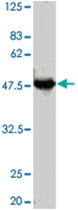 SPT3, Rabbit, Polyclonal Antibody, Abnova 50 &mu;L | Buy Online | Abnova Corporation | Fisher Scientific