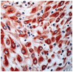 FLT4 Rabbit anti-Human, Polyclonal Antibody, Abnova 100&mu;L; Unlabeled:Antibodies,