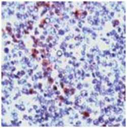 GZMB, Rabbit, Polyclonal Antibody, Abnova 100&mu;L; Unlabeled:Antibodies,