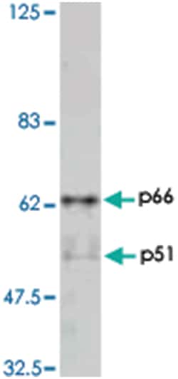 HIV-1 reverse transcriptase, Rabbit, Polyclonal Antibody, Abnova 50&mu;L;