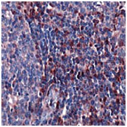S100A4 Rabbit anti-Human, Polyclonal Antibody, Abnova 100&mu;L; Unlabeled:Antibodies,
