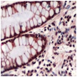 THRB Rabbit anti-Human, Polyclonal Antibody, Abnova 100&mu;L; Unlabeled:Antibodies,