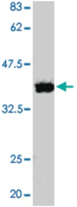 RAD51 Rabbit anti-Chicken, Human, Mouse, Polyclonal Antibody, Abnova 50&mu;L;