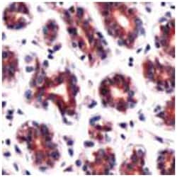 DAPK2 Rabbit anti-Human, Polyclonal Antibody, Abnova 100 &mu;L | Buy Online | Abnova Corporation | Fisher Scientific
