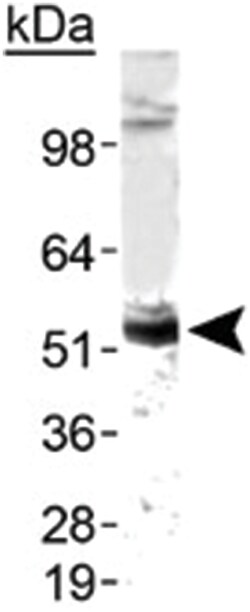 ZMPSTE24 Rabbit anti-Human, Mouse, Primates, Zebra fish, Polyclonal Antibody, Abnova 100 &mu;L | Buy Online | Abnova | Fisher Scientific