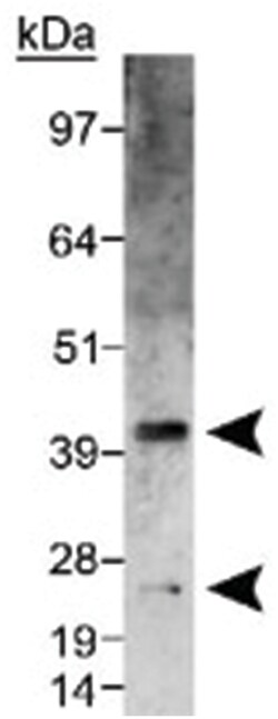 VEGFA Rabbit anti-Bovine, Chicken, Dog, Guinea pig, Horse, Human, Mouse, Pig, Primates, Rat, Sheep, Polyclonal Antibody, Abnova 100 &mu;L | Buy Online | Abnova Corporation | Fisher Scientific