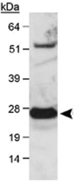 UCHL1 Rabbit anti-Horse, Human, Mouse, Pig, Primates, Rat, Polyclonal Antibody,