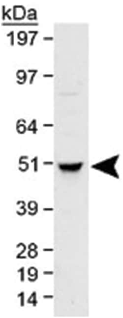 TUBB Rabbit anti-Chicken, Human, Mouse, Pig, Primates, Rat, Xenopus, Zebra