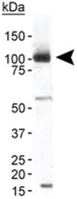 TRPA1 Rabbit anti-Human, Mouse, Polyclonal Antibody, Abnova 100&mu;L; Unlabeled:Antibodies,