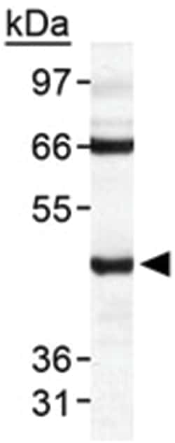 TARDBP Rabbit anti-Chicken, Human, Mouse, Primates, Xenopus, Zebra fish, Polyclonal Antibody, Abnova 100 &mu;L | Buy Online | Abnova Corporation | Fisher Scientific