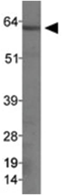 SSTR1 Rabbit anti-Human, Mouse, Rat, Polyclonal Antibody, Abnova 100&mu;L;